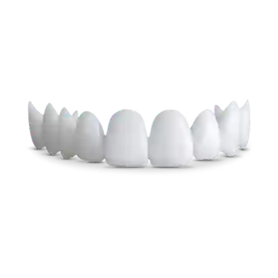 shiny smile veneers top pricing
