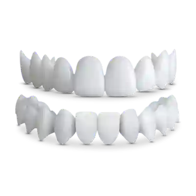 shiny smile veneers top_bottom pricing